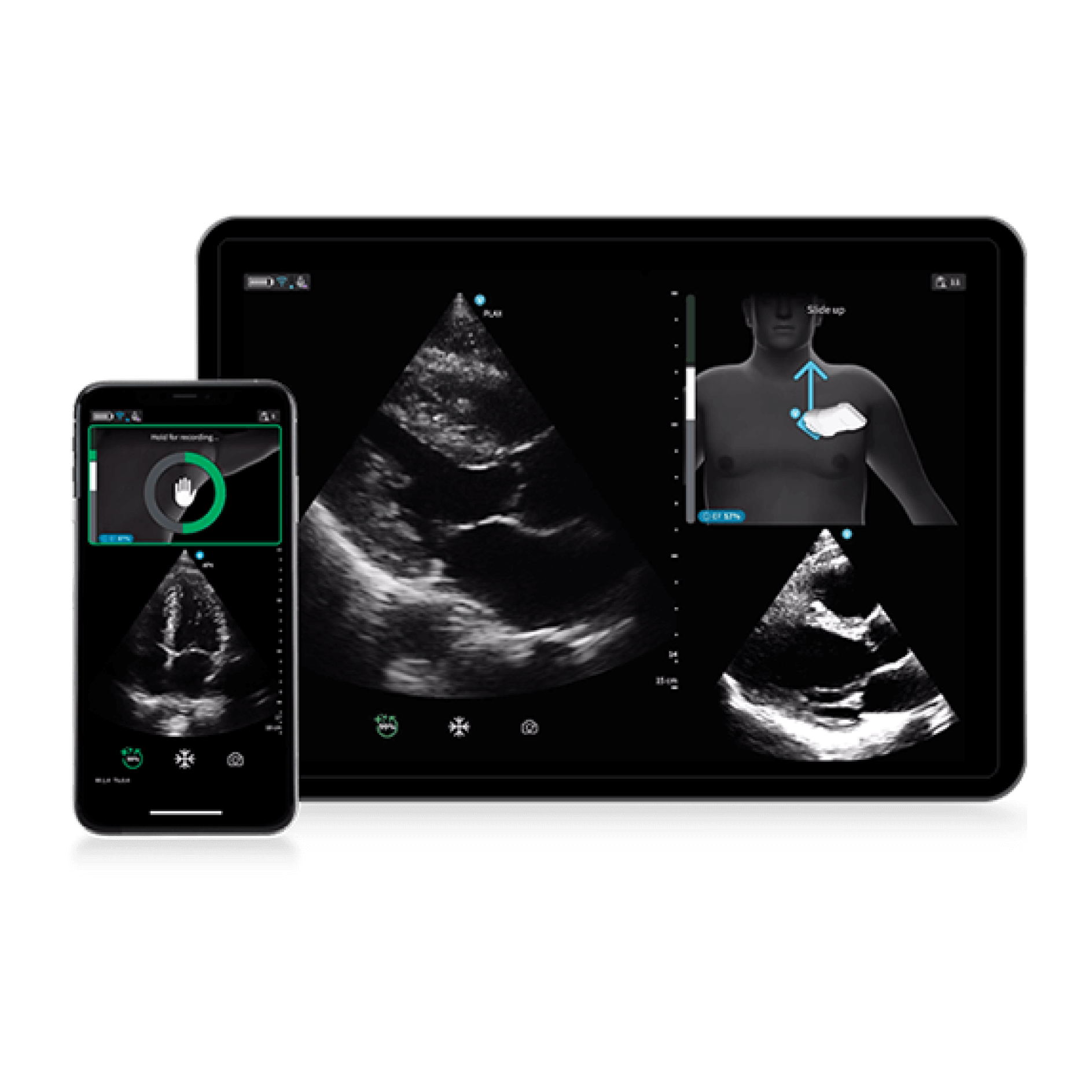 Vscan Air SL Caption AI (Stand-alone) FlexiPackage EUR